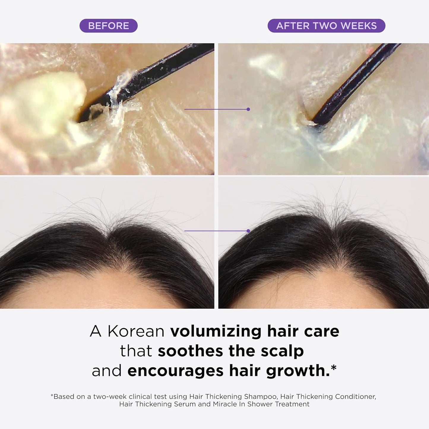 Dr. Groot Thickening Serum, Shampoo, Conditioner, and Scalp Treatment Set for Hair Loss